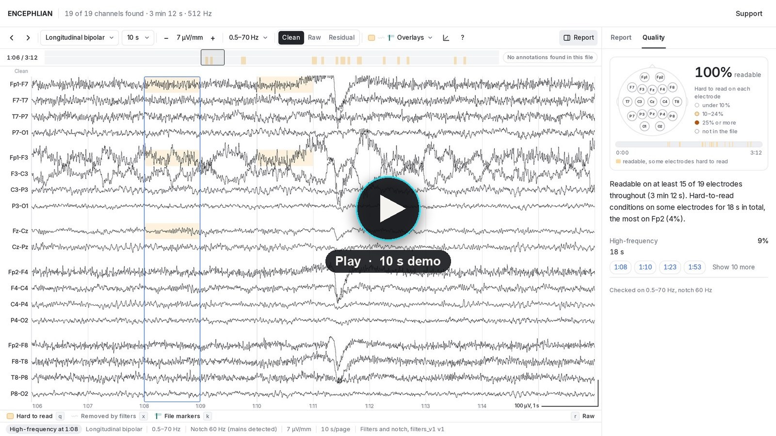 Screen recording of ENCEPHLIAN Review opening a public EEG file, checking it and showing the signal-quality map