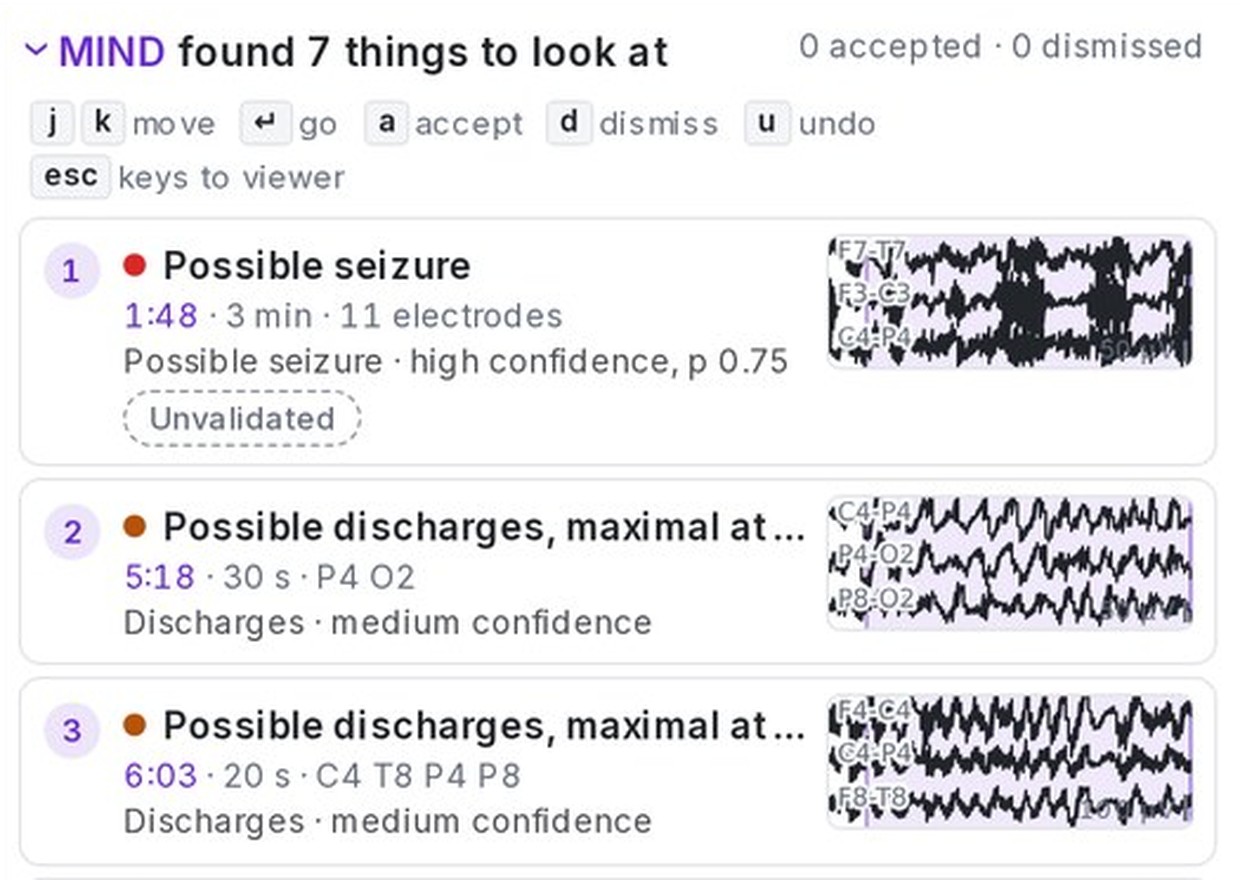MIND review list in the product